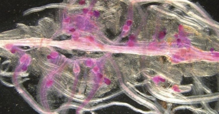 Таинственный мир фитопаразитических галловых нематод постепенно раскрывает свои секреты ученым - фото