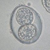  Oocysts of Eimeria coccidia