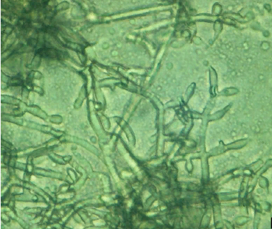 Trichoderma veride штамм 471 - Колония Trichoderma veride 