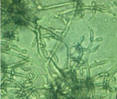 Trichoderma veride штамм 471 - Колония Trichoderma veride 