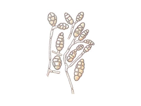 Демациевые - Alternaria radicina Meier, Drechsler et E.D. Eddy - фото