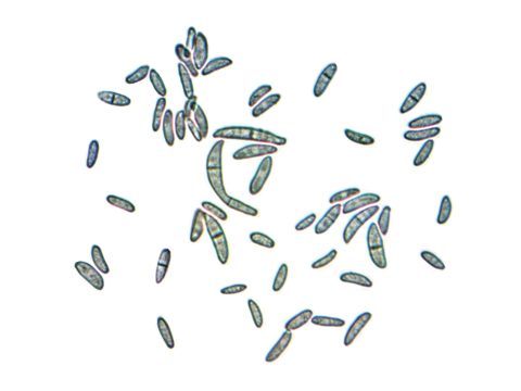 Туберкуляриевые - Fusarium solani - фото