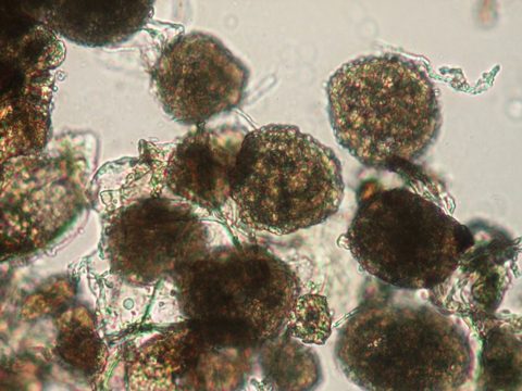 Плазмодиофоровые - Spongospora subterranea - фото