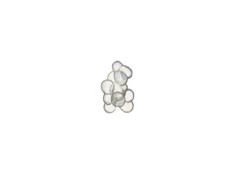 Устилягиновые - Sorosporium reilianum (Kuehn) Mc Alp. - фото