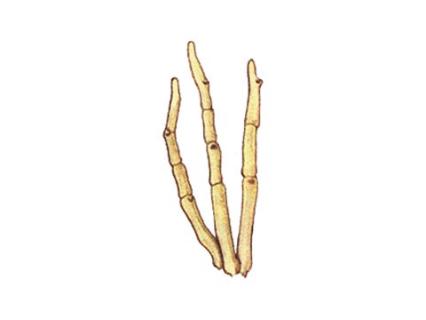 Массариновые - Helminthosporium turcicum Pass. - фото