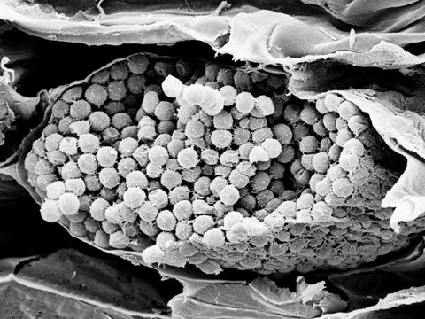 Плазмодиофоровые - Plasmodiophora brassicae Woronin. - фото