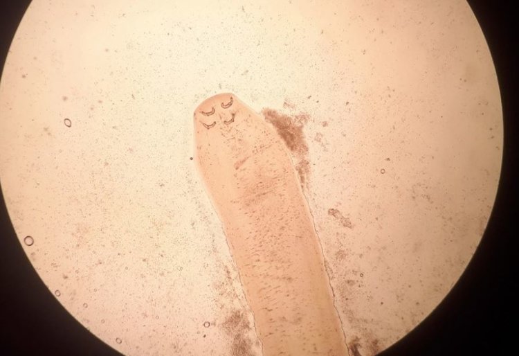 В щуке из водоемов Красноярского края обнаружили возбудителей триенофороза