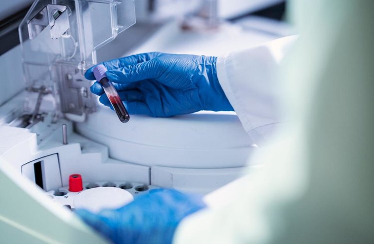 Для борьбы с догхантерами ученые ВНИИЗЖ разработали первую российскую методику определения изониазида в патматериале животных