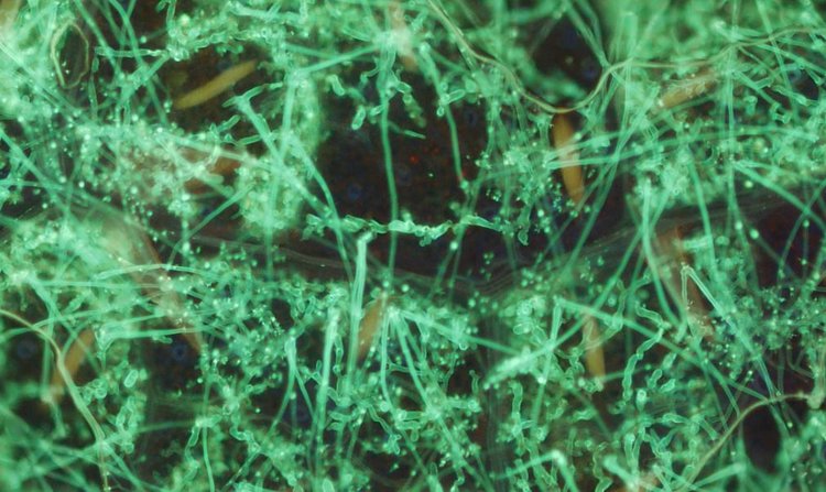 Биостимуляторы и фунгициды: выгодное сочетание для защиты винограда от милдью