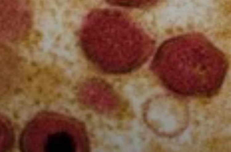 Ученые оценят функцию тысяч генов в клетках домашних свиней и бородавочников в поисках устойчивости к АЧС