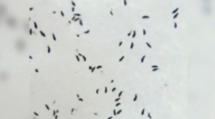 Снежные блохи озадачили кировских сельчан - фото